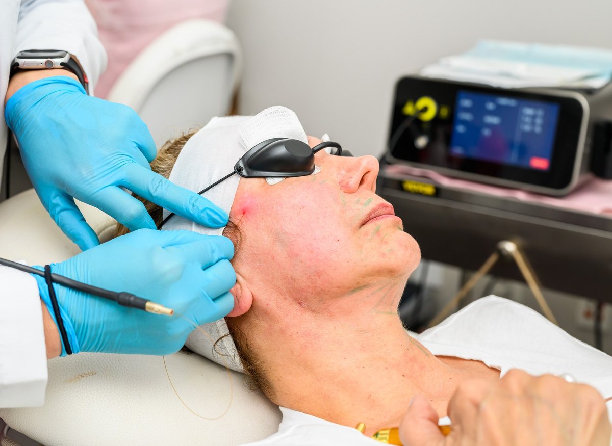 A patient in protective eyewear during a laser treatment
